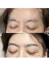 アイリー(IRIE)/ハリウッドブロウリフト