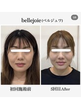 ベルジュワ(bellejoie)/