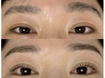 ノズ(NOZ)/まつ毛眉毛Before/After