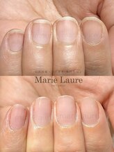 マリーロール 梅田店(Marie Laure)/深爪改善/自爪育成/ネイルケア
