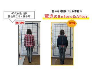 にこにこ整体 整骨院/【四十・猫背矯正】整体をBE⇒AF