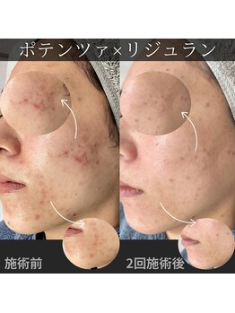 サロン イニ(SALON INI)/【ポテンツァ×リジュラン】