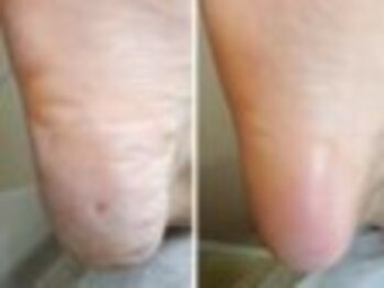 リゼラアンドコー 盛岡店/ドイツ式フットケア専門店