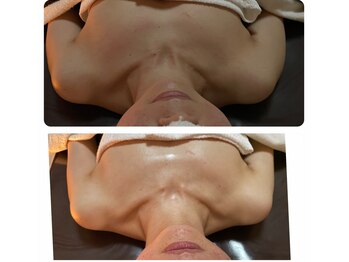 ヒラキヒミ。/毛穴洗浄+90分リンパ (120分)