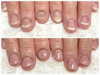 グレースレディ 大阪店/(深爪/長さだし/フィルイン)