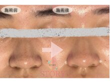 ストーリー(STORY)/眉毛と艶肌ワックス専門店