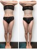 【7月まで】4D全身2回目モニター写真&口コミ投稿で¥15000→¥9000