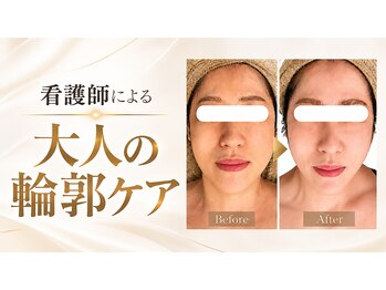 エン 橿原店(en)の写真/「最近、顔が変わってきた？」たるみ・ほうれい線・頬コケ、あれこれ気になるお顔の悩みをまとめてケア◎