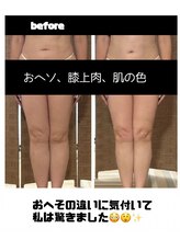 Lier&/復元エステ 前面