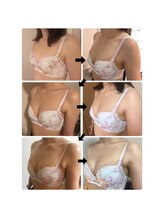 レイア 中城店(RayA)/産後のバストもお任せください♪