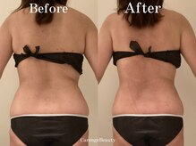 カレンジェビューティー(CarengeBeauty)/四日市痩身/スリムカッター