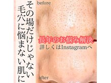 エラ(Ella)の雰囲気（徹底毛穴ケアで黒ずみ開き角栓を改善♪諦める前にお試し下さい！）