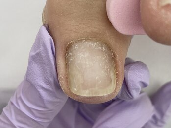 爪処 中野坂上/トラブル爪