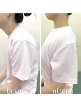 カイロライン松本整体院/肩こり×猫背矯正 / BeforeAfter