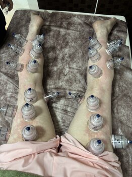 ひめ酵素ワーム(Warm)の写真/【プチ贅沢温巡美活コース】酵素風呂+シートP+全身カッピング12100→8800円