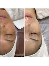 オージャス(OJAS)/51歳　3ヶ月で艶玉ノーファンデ