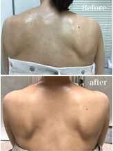 オーパーツ(OOPARTS)/血流ケアで背中のラインを整える