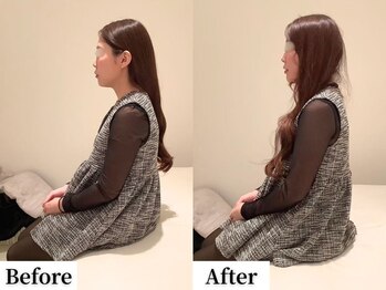 ソレア(Solea)/姿勢改善1回目 Before/After