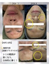 リラックスアンドビューティ(Relax&Beauty)/本気でシミ改善