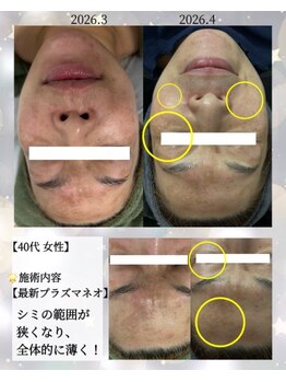 リラックスアンドビューティ(Relax&Beauty)/本気でシミ改善