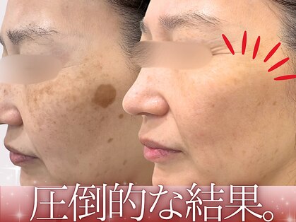 ハウオリ(HAUOLI)の写真