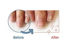 ネイルケアタイム 西葛西店(NAIL CARE TiME)/Before/After