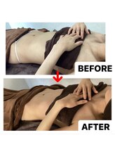 ブーケ/フェムケア　Before & After