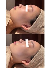 ディオーネ 春日井勝川店(Dione)/マーメイド☆ビフォーアフター