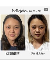 ベルジュワ(bellejoie)/