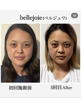 ベルジュワ(bellejoie)/