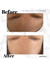 ワイドット(Y.)/くすみリセット