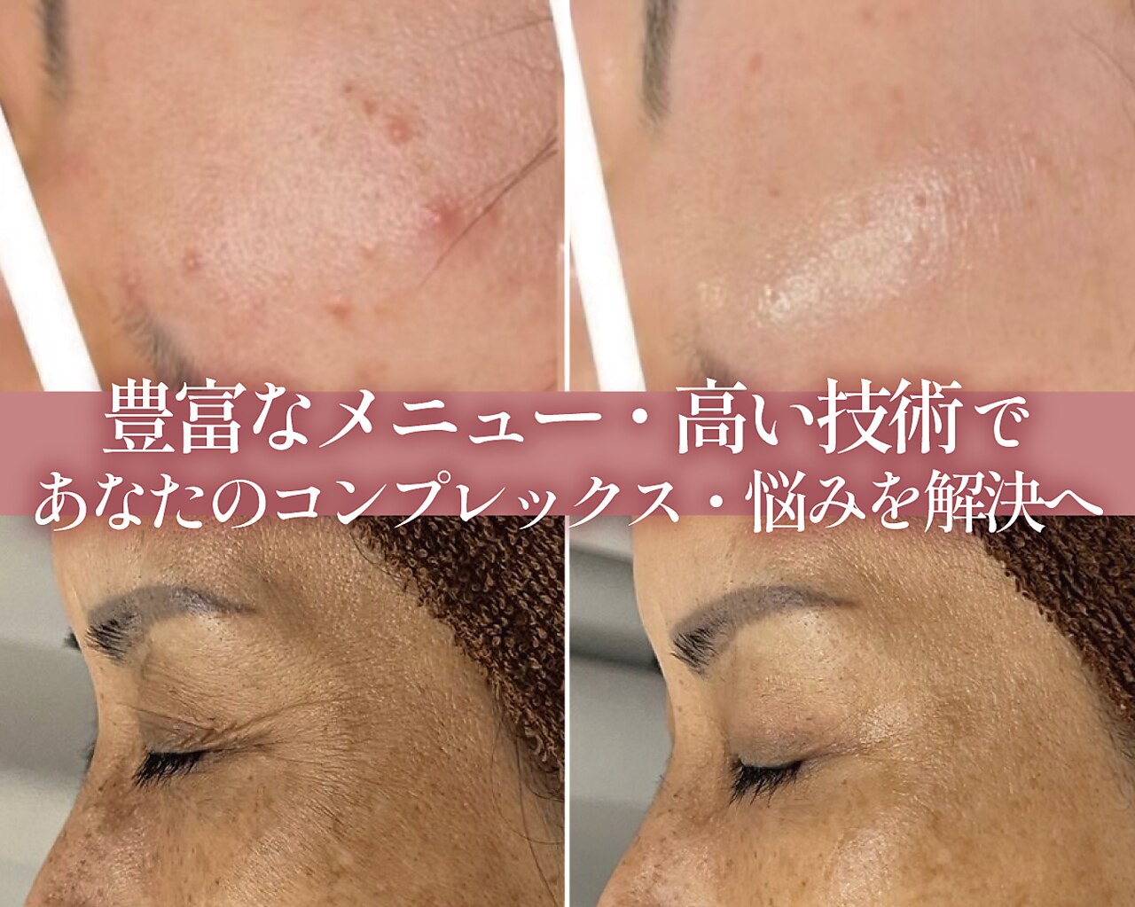筑後市でEMSが人気のエステサロン｜ホットペッパービューティー