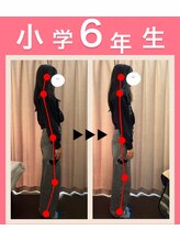 キララ 美容矯正/スマホ首も1回で正しい位置に♪