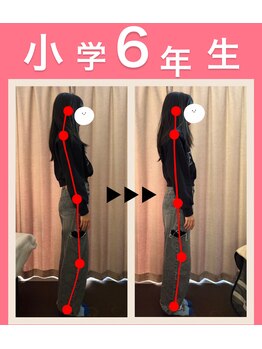 キララ 美容矯正/スマホ首も1回で正しい位置に♪