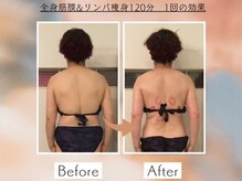 シェルシア(Cielcia)/全身筋膜＆リンパ痩身+小顔120分