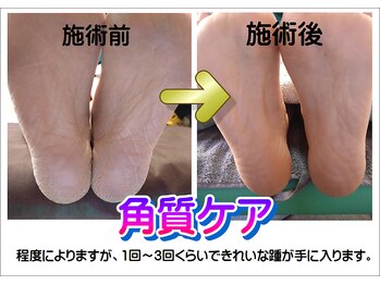 リラコン 那由多(RelaCon.)/角質ケア　好評です♪