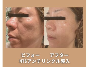 アオイスター(AOIstar)/私！