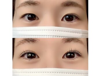 リット(LIT)/ダブルアイリフト