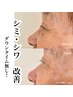 【5名様限定お試し3回】肌悩み徹底的に改善コース￥58500（30%オフ）→¥40950