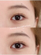 アミーラ(Amira)/フラットラッシュ上下