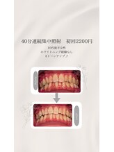 プラスビーセルフ(+b self)/ホワイトニングビフォーアフター