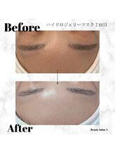 ワイドット(Y.)/白雪姫へ