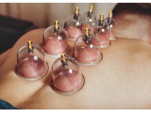 サロンドカメリア(salon de Camellia)の雰囲気（台湾式オイルリンパは強揉み好きの方に◎カッピングも人気です）