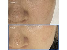 ホジュン鍼灸整体院/