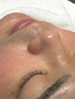 毛穴ケアをしたい