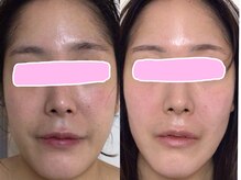 サロン ジョリー(Salon Jolie)/ノーファンデにシフトチェンジ