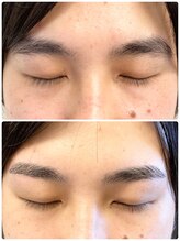 アイビー 人形町店(i.b)/眉【before⇒after】４２