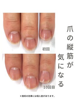 最強ネイルケア