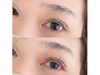 シュエット(Chouette)/アンドヘルシー100本