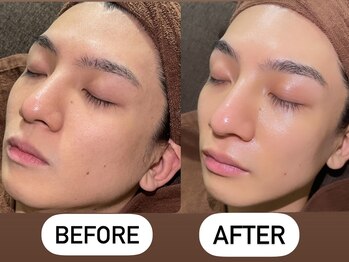 ソーレエルーナ(SOLE e LUNA)/フェイシャルのオールスター◎